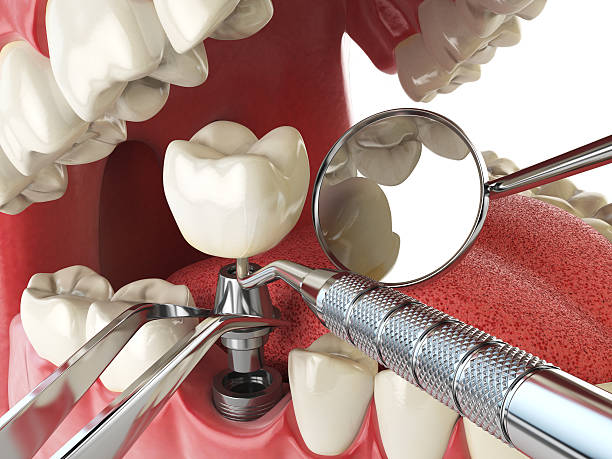 Best Emergency Treatment for Jaw Pain or Injury in Sughter, LA